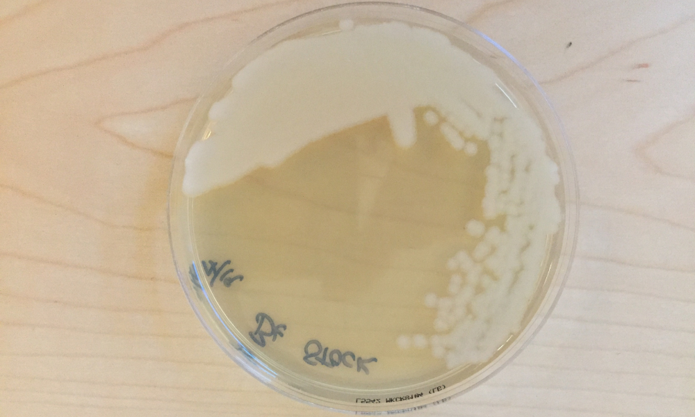 Petri dish with milky substance.